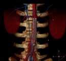 U24. Medical Imaging- ANGIOGRAPHY