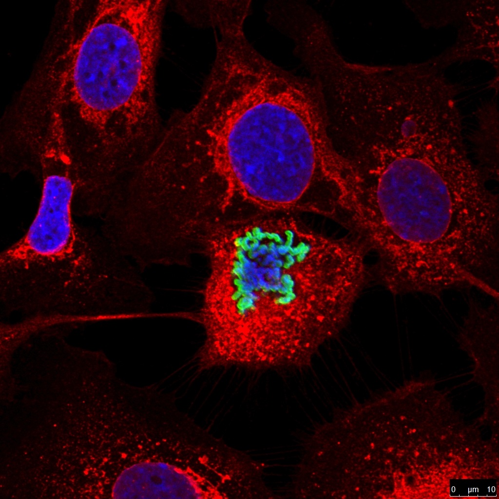 U17 Nanbiosis-Best picture scientific 2014 award for Ana Belén Fernández Martínez and M. Isabel Trabado Jimenez